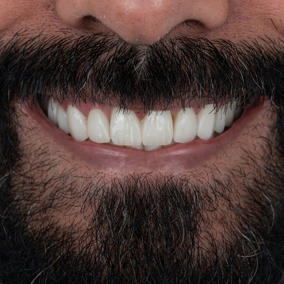 ultima dental-1