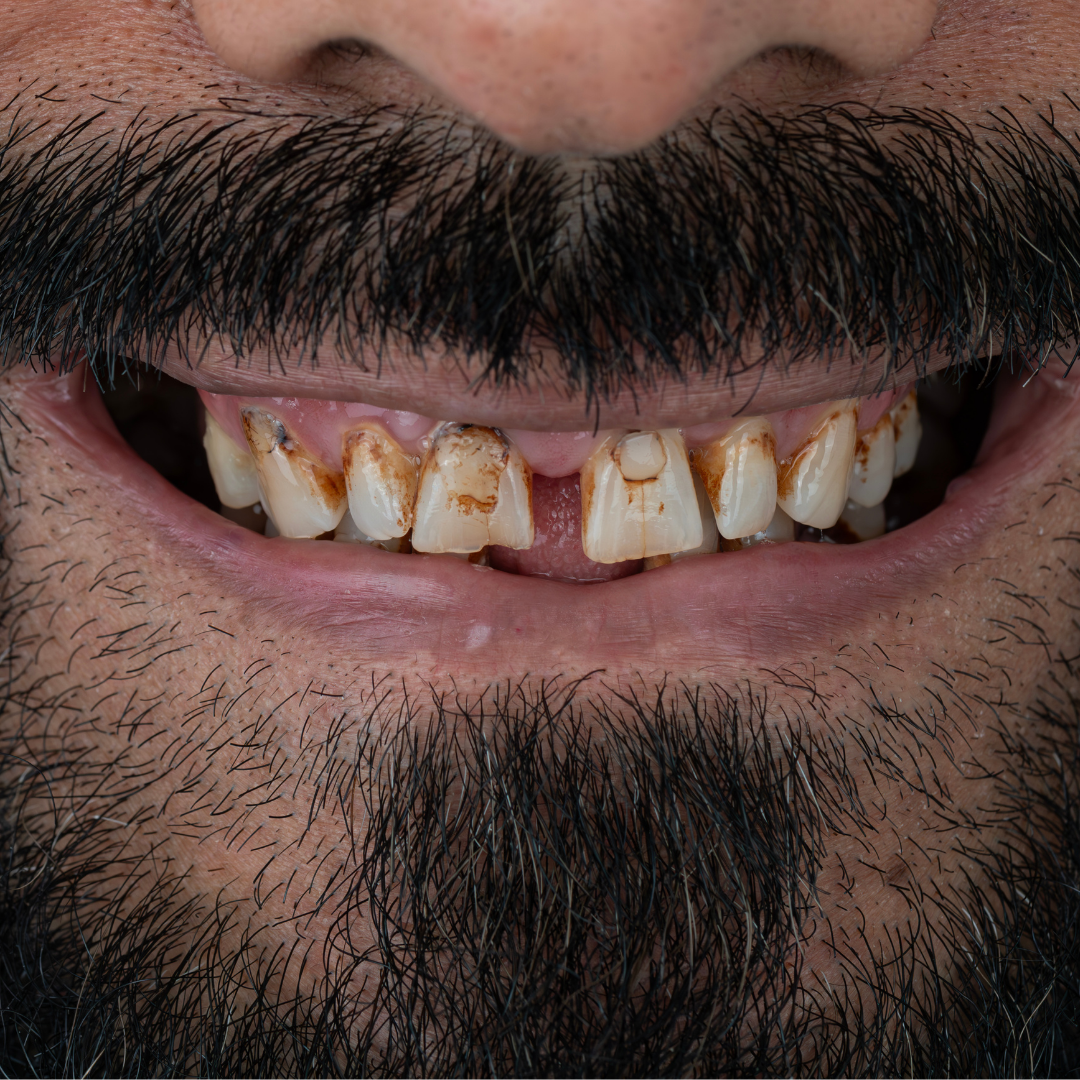 ultima dental